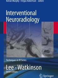 Interventional Neuroradiology