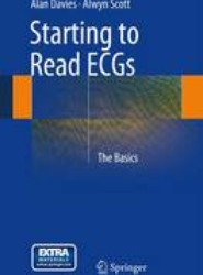 Starting to Read ECGs