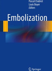 Embolization