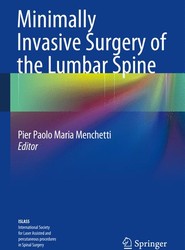 Minimally Invasive Surgery of the Lumbar Spine