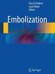 Embolization