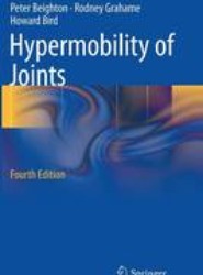 Hypermobility of Joints