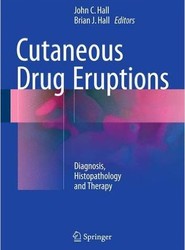 Cutaneous Drug Eruptions