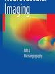 Neurovascular Imaging