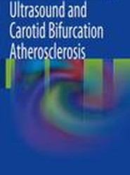 Ultrasound and Carotid Bifurcation Atherosclerosis