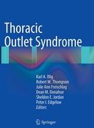 Thoracic Outlet Syndrome