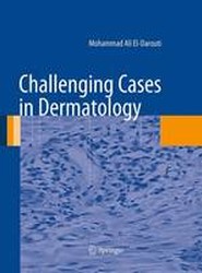 Challenging Cases in Dermatology