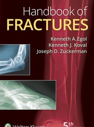 Handbook of Fractures