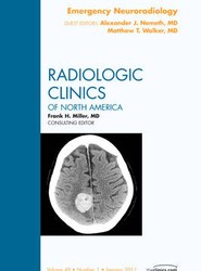 Emergency Neuroradiology, An Issue of Radiologic Clinics of North America: Volume 49-1