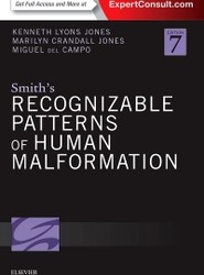 Smith's Recognizable Patterns of Human Malformation