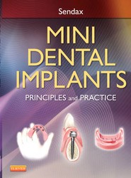 Mini Dental Implants