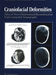 Craniofacial Deformities