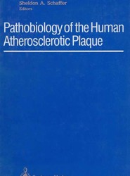 Pathobiology of the Human Atherosclerotic Plaque