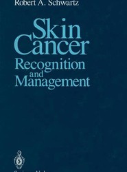 Skin Cancer