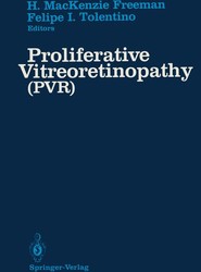Proliferative Vitreoretinopathy (PVR)