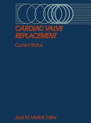 Cardiac Valve Replacement