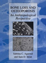 Bone Loss and Osteoporosis