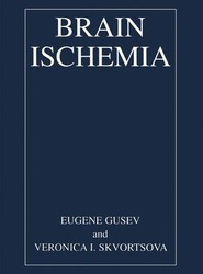 Brain Ischemia