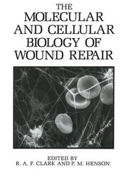 The Molecular and Cellular Biology of Wound Repair