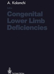 Congenital Lower Limb Deficiencies