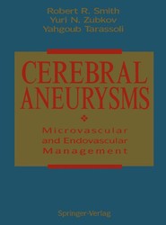 Cerebral Aneurysms