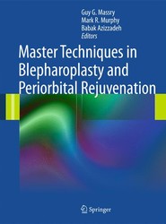 Master Techniques in Blepharoplasty and Periorbital Rejuvenation
