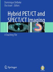 Hybrid PET/CT and SPECT/CT Imaging