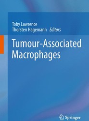 Tumour-Associated Macrophages
