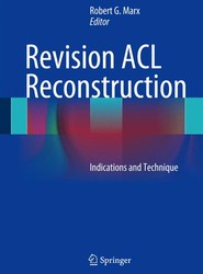 Revision ACL Reconstruction