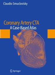 Coronary Artery CTA