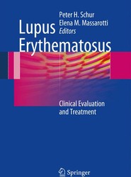 Lupus Erythematosus