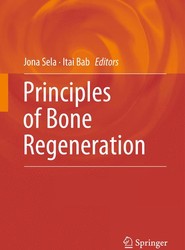Principles of Bone Regeneration