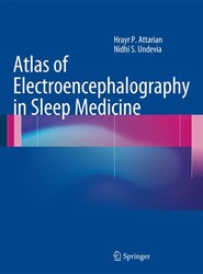 Atlas of Electroencephalography in Sleep Medicine