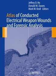 Atlas of Conducted Electrical Weapon Wounds and Forensic Analysis