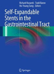 Self-Expandable Stents in the Gastrointestinal Tract