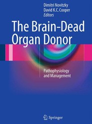 The Brain-Dead Organ Donor