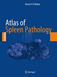 Atlas of Spleen Pathology