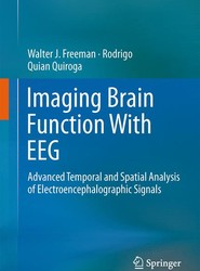 Imaging Brain Function With EEG