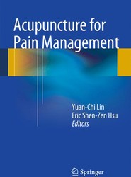 Acupuncture for Pain Management