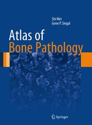 Atlas of Bone Pathology