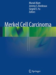 Merkel Cell Carcinoma