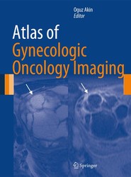 Atlas of Gynecologic Oncology Imaging