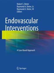 Endovascular Interventions