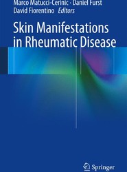 Skin Manifestations in Rheumatic Disease