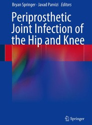 Periprosthetic Joint Infection of the Hip and Knee