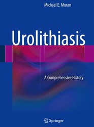 Urolithiasis