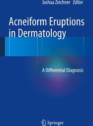 Acneiform Eruptions in Dermatology