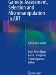 Gamete Assessment, Selection and Micromanipulation in ART
