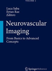 Neurovascular Imaging