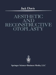 Aesthetic and Reconstructive Otoplasty